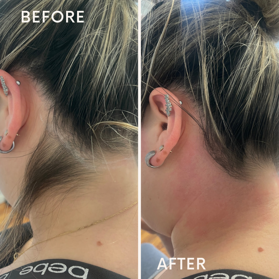 Skin treatment close-up